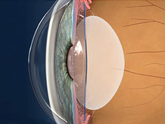 image of anatomy of eye