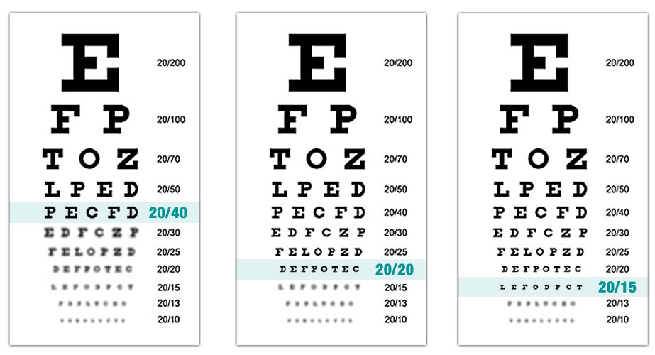 eye charts that demonstrate different levels of vision
